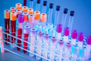 Can a Blood Test Detect Traumatic Brain Injury