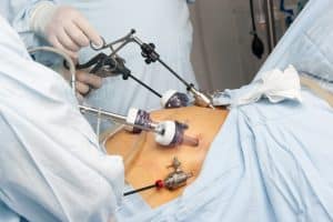 Gastric Bypass Surgical Errors in Washington DC
