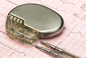 Failing Pacemakers Show Us the High Cost of Replacing Defective Medical Devices