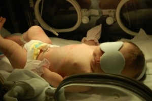 Kernicterus and Untreated Jaundice in Newborns