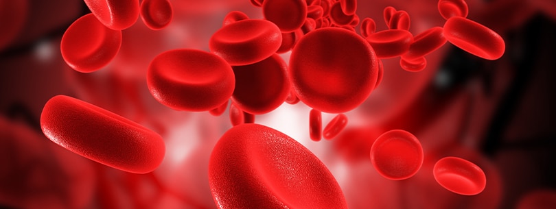 Sepsis Sepsis